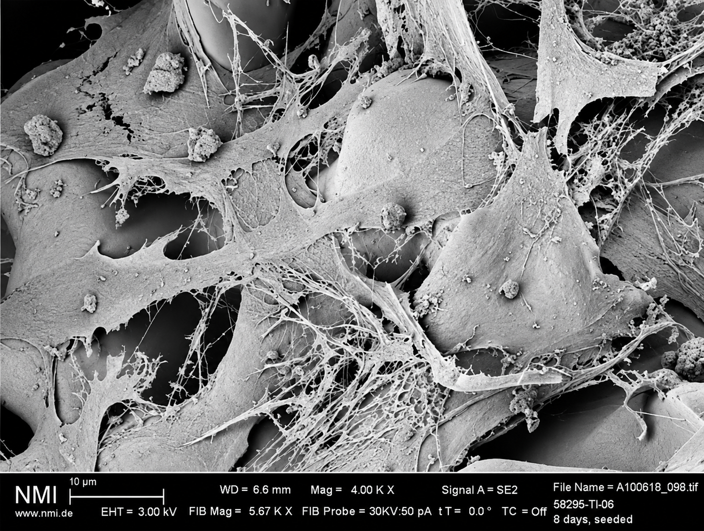 Mineralization and the formation of strong bone-to-implant contact occur.